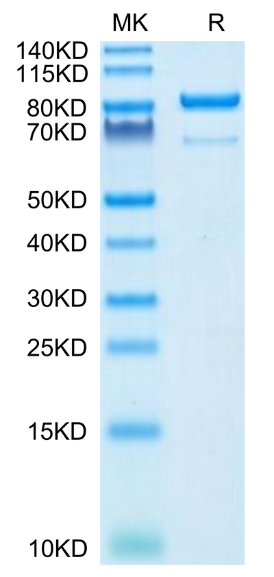 Human CD73 on Tris-Bis PAGE under reduced condition. The purity is greater than 95%.