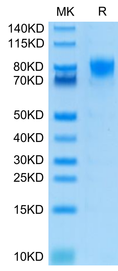 Human DNAM-1 on Tris-Bis PAGE under reduced condition. The purity is greater than 95%.