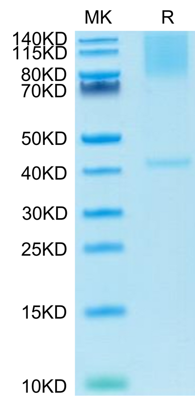 Cynomolgus GPC3 on Tris-Bis PAGE under reduced condition. The purity is greater than 95%.
