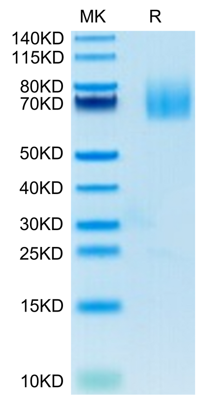 Human CD27 Ligand on Tris-Bis PAGE under reduced condition. The purity is greater than 95%.