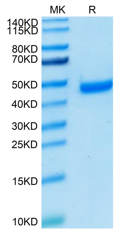Human Nectin-4 on Tris-Bis PAGE under reduced condition. The purity is greater than 95%.