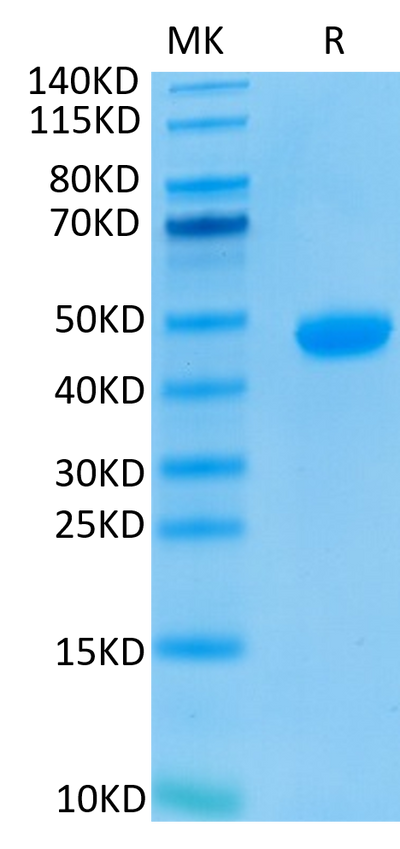 Biotinylated Human Nectin-4 on Tris-Bis PAGE under reduced conditions. The purity is greater than 95%.