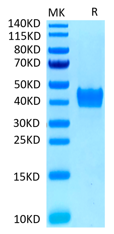 Human CD52 on Tris-Bis PAGE under reduced conditions. The purity is greater than 95%.