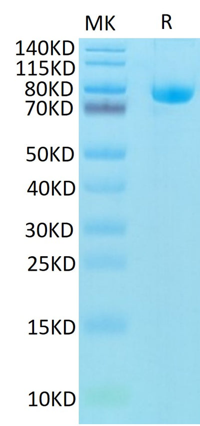 Biotinylated Human CD5 on Tris-Bis PAGE under reduced condition. The purity is greater than 95%.