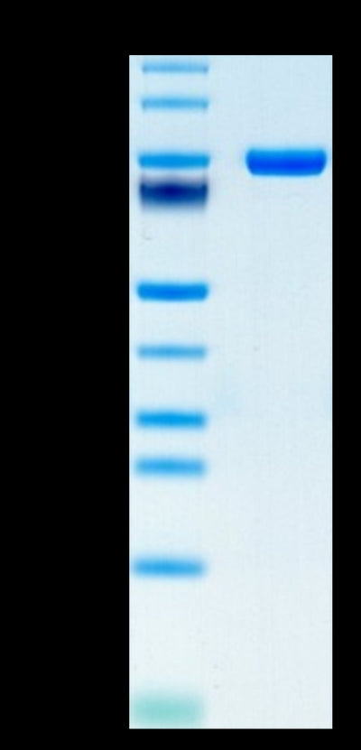 Human CD5 on Tris-Bis PAGE under reduced condition. The purity is greater than 95%.