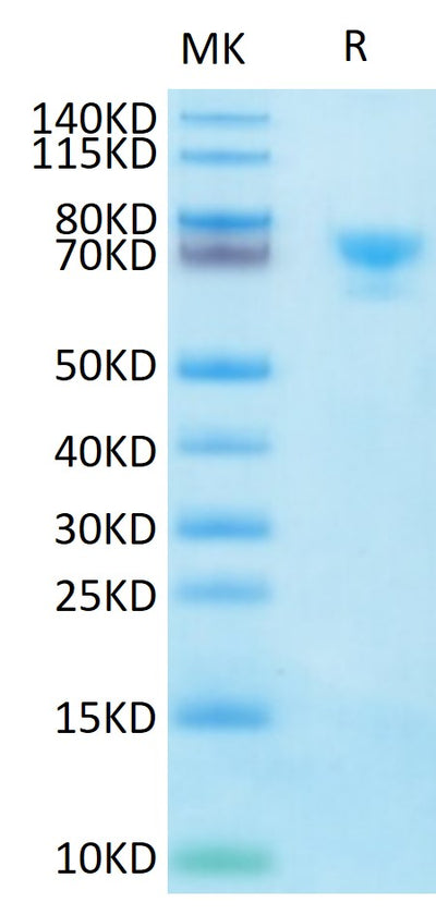 Biotinylated Human MSLN on Tris-Bis PAGE under reduced condition. The purity is greater than 95%.