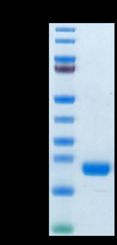 Biotinylated Human CD20 on Tris-Bis PAGE under reduced condition. The purity is greater than 95%.