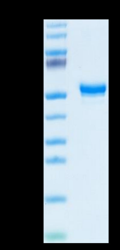 Human CD160 on Tris-Bis PAGE under reduced condition. The purity is greater than 95%.