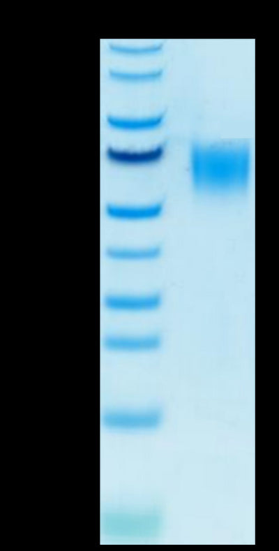 Biotinylated Human CD200 R1 on Tris-Bis PAGE under reduced condition. The purity is greater than 95%.