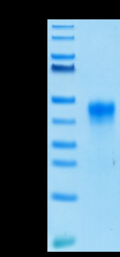 Biotinylated Human FOLR1 on Tris-Bis PAGE under reduced condition. The purity is greater than 95%.