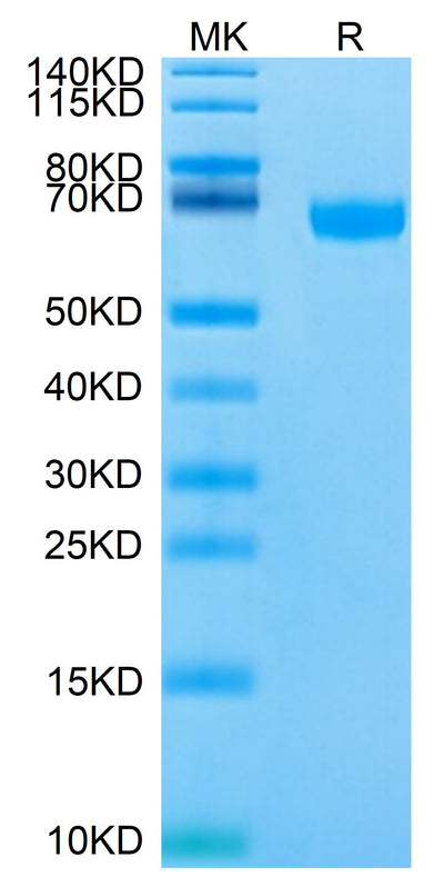 Biotinylated Human/Cynomolgus/Rhesus macaque ROR1 on Tris-Bis PAGE under reduced condition. The purity is greater than 95%.