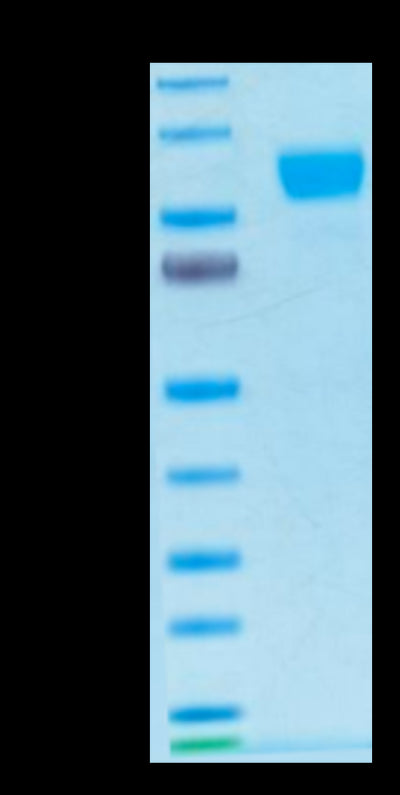 Biotinylated Human Her2 on Tris-Bis PAGE under reduced condition. The purity is greater than 95%.
