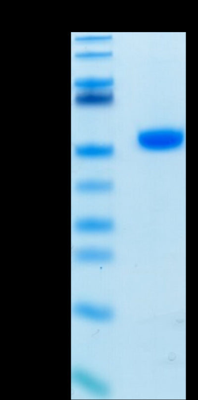 Biotinylated Human CD4 on Tris-Bis PAGE under reduced condition. The purity is greater than 95%.