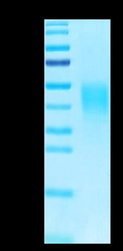 Biotinylated Human CLEC12A on Tris-Bis PAGE under reduced condition. The purity is greater than 95%.