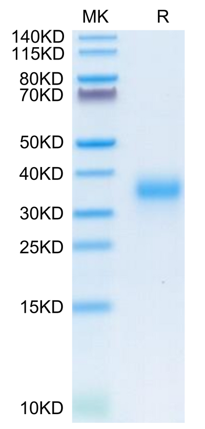 Human CD74 on Tris-Bis PAGE under reduced condition. The purity is greater than 95%.