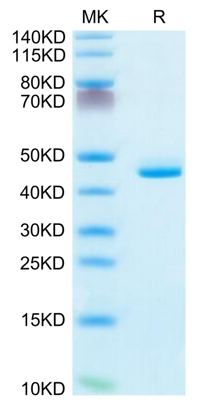 Human CD5L on Tris-Bis PAGE under reduced condition. The purity is greater than 95%.