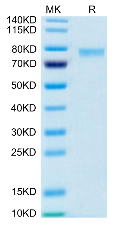 Biotinylated Human 4-1BB Ligand (Trimer) on Tris-Bis PAGE under reduced condition. The purity is greater than 95%.
