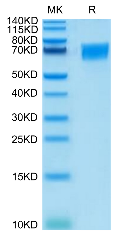 Human CD58 on Tris-Bis PAGE under reduced condition. The purity is greater than 95%.