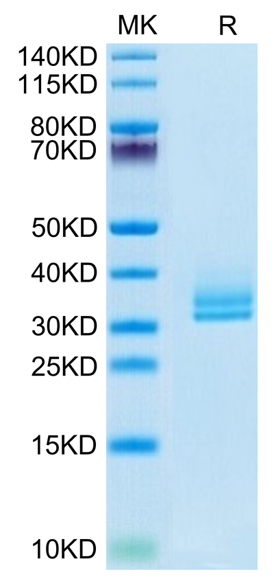 Biotinylated Human ANGPTL2 on Tris-Bis PAGE under reduced condition. The purity is greater than 95%.