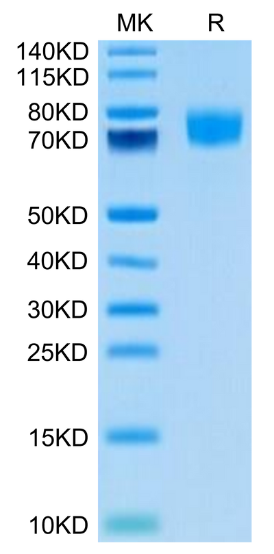 Biotinylated Human ALCAM (Primary Amine Labeling) on Tris-Bis PAGE under reduced condition. The purity is greater than 95%.
