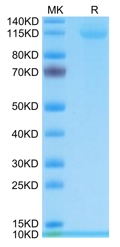 Human CD42b on Tris-Bis PAGE under reduced condition. The purity is greater than 95%.