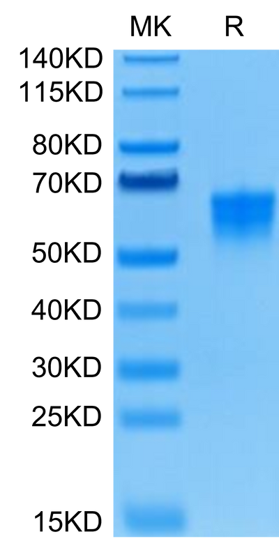 Human B7-H4 on Tris-Bis PAGE under reduced condition. The purity is greater than 95%.