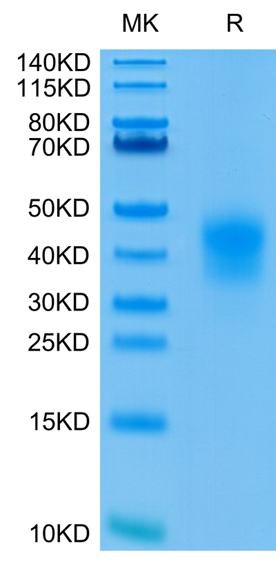 Human CD79B on Tris-Bis PAGE under reduced condition. The purity is greater than 95%.