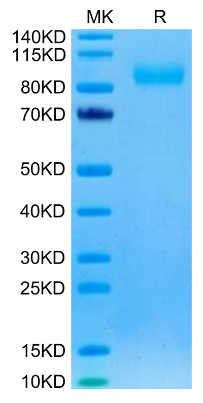 Rhesus macaque EGFR on Tris-Bis PAGE under reduced condition. The purity is greater than 95%.