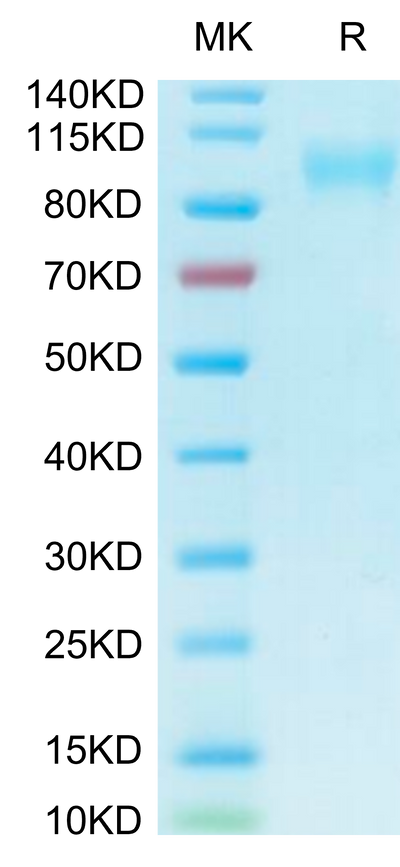 Biotinylated Human ACE2 on Tris-Bis PAGE under reduced condition. The purity is greater than 95%.