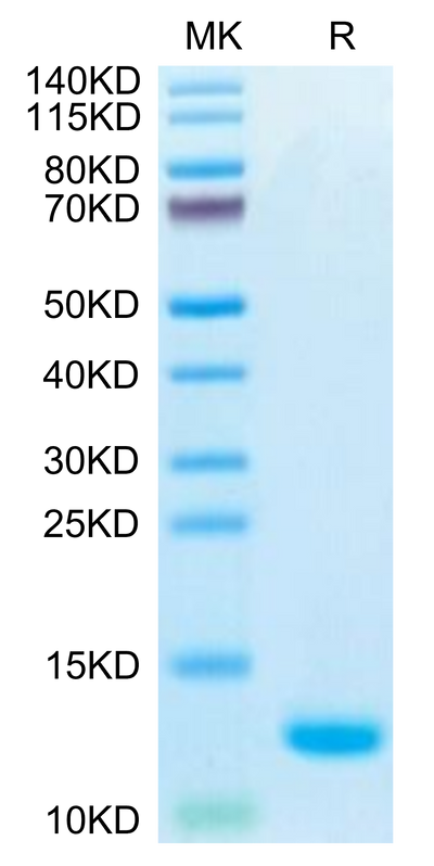 Biotinylated Human CCL5 on Tris-Bis PAGE under reduced condition. The purity is greater than 95%.