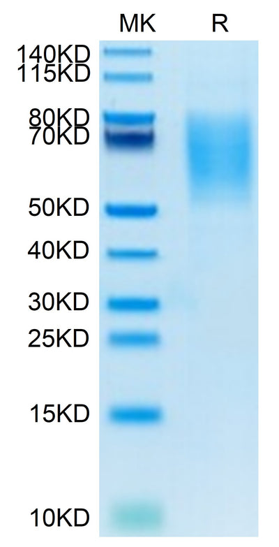 Biotinylated Human CA125 on Tris-Bis PAGE under reduced conditions. The purity is greater than 95%.
