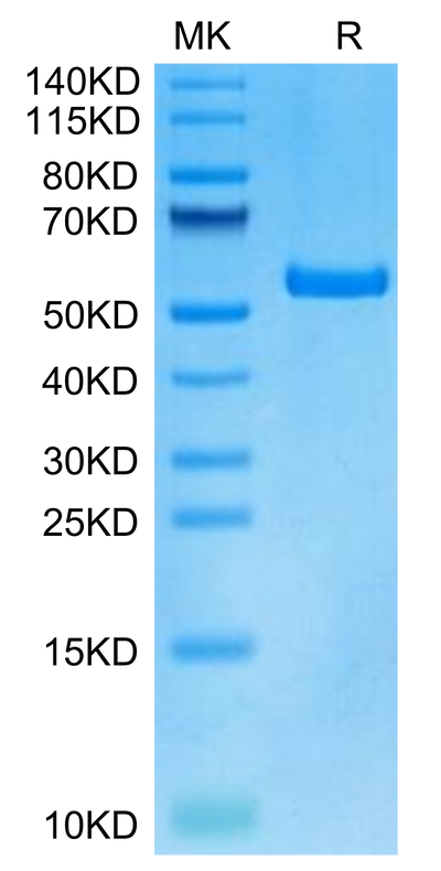Human HLA-A*01:01&B2M&DSG3 (YTDNWLAVY) Monomer on Tris-Bis PAGE under reduced condition. The purity is greater than 95%.