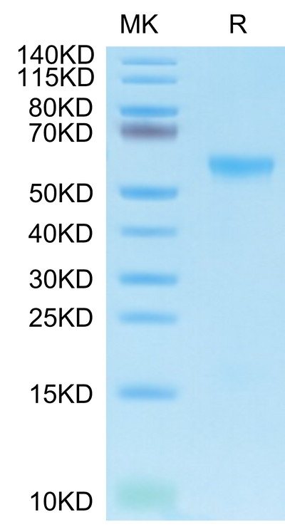 Biotinylated Human APRIL Trimer on Tris-Bis PAGE under reduced condition. The purity is greater than 90%.