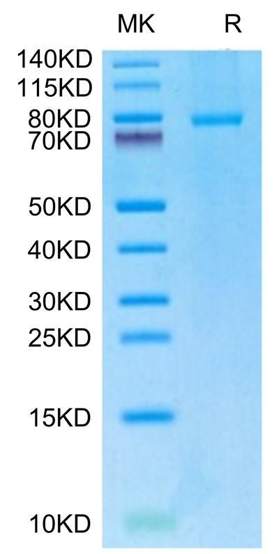 Human CD40 Ligand (Trimer) on Tris-Bis PAGE under reduced condition. The purity is greater than 95%.