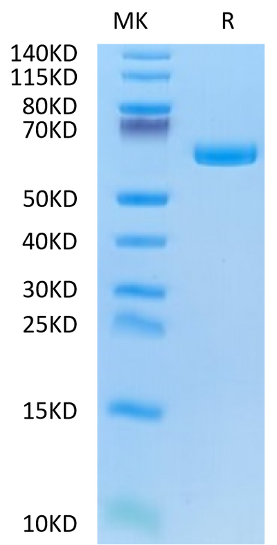 Biotinylated Human Alkaline Phosphatase (Germ type) on Tris-Bis PAGE under reduced condition. The purity is greater than 95%.