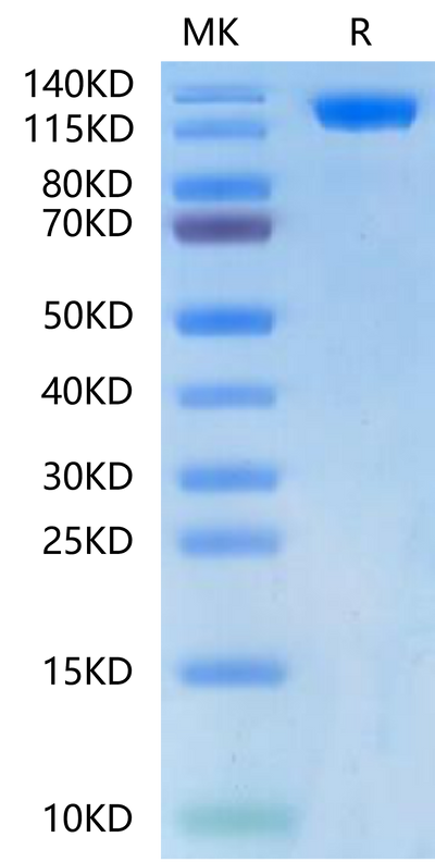 Biotinylated Human ACE2 on Tris-Bis PAGE under reduced condition. The purity is greater than 95%.