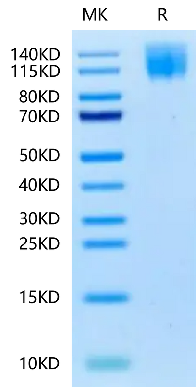Biotinylated Human CEACAM-5 on Tris-Bis PAGE under reduced condition. The purity is greater than 95%.