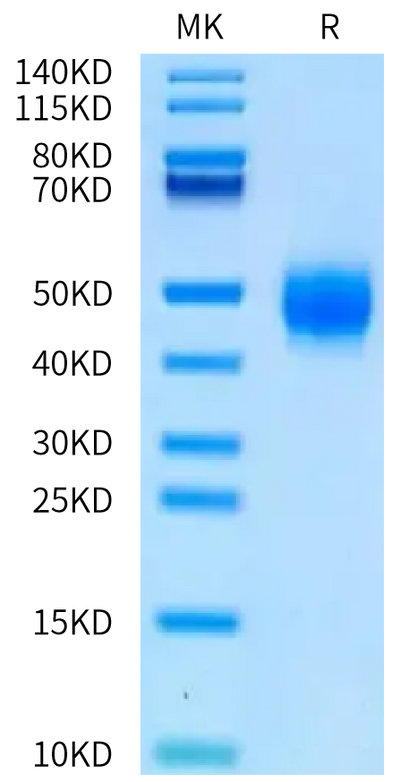 Biotinylated Human BTN2A1 on Tris-Bis PAGE under reduced condition. The purity is greater than 95%.