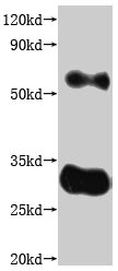 Western Blot this product is detected by Anti-Claudin 18 Antibody.The two bands respectively correspond to monomer, Homodimer