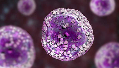 B-cell lymphoma is a type of blood cancer that begins in the B lymphocytes, an important part of the immune system responsible for fighting infections. 