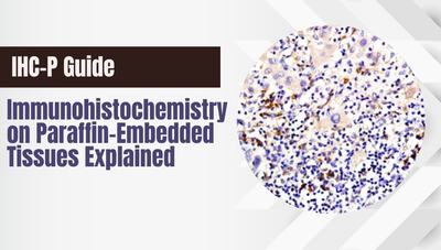 IHC-P Guide: Immunohistochemistry on Paraffin-Embedded Tissues Explained