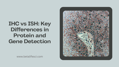 IHC vs ISH: Key Differences in Protein and Gene Detection