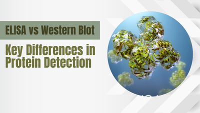 ELISA vs Western Blot: Key Differences in Protein Detection