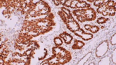 Understanding IHC Staining for Accurate Tissue Analysis