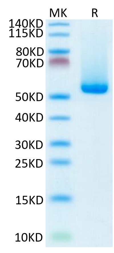 Biotinylated Human HLA-A*02:01&B2M&NY-ESO-1 (SLLMWITQC) Monomer on Tris-Bis PAGE under reduced condition. The purity is greater than 95%.Biotinylated Human HLA-A*02:01&B2M&NY-ESO-1 (SLLMWITQC) Monomer Protein, Active