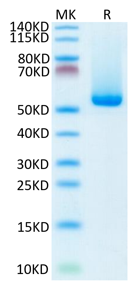 Biotinylated Human HLA-A*02:01&B2M&NY-ESO-1 (SLLMWITQC) Monomer on Tris-Bis PAGE under reduced condition. The purity is greater than 95%.Biotinylated Human HLA-A*02:01&B2M&NY-ESO-1 (SLLMWITQC) Monomer Protein, Active