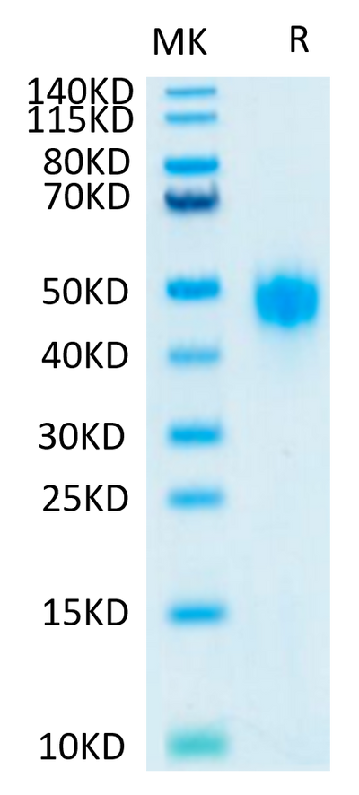 Human KIR2DL3 on Tris-Bis PAGE under reduced conditions. The purity is greater than 95%.Recombinant Human KIR2DL3 Protein