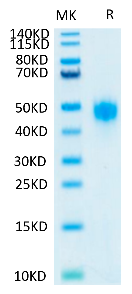 Human KIR2DL3 on Tris-Bis PAGE under reduced conditions. The purity is greater than 95%.Recombinant Human KIR2DL3 Protein