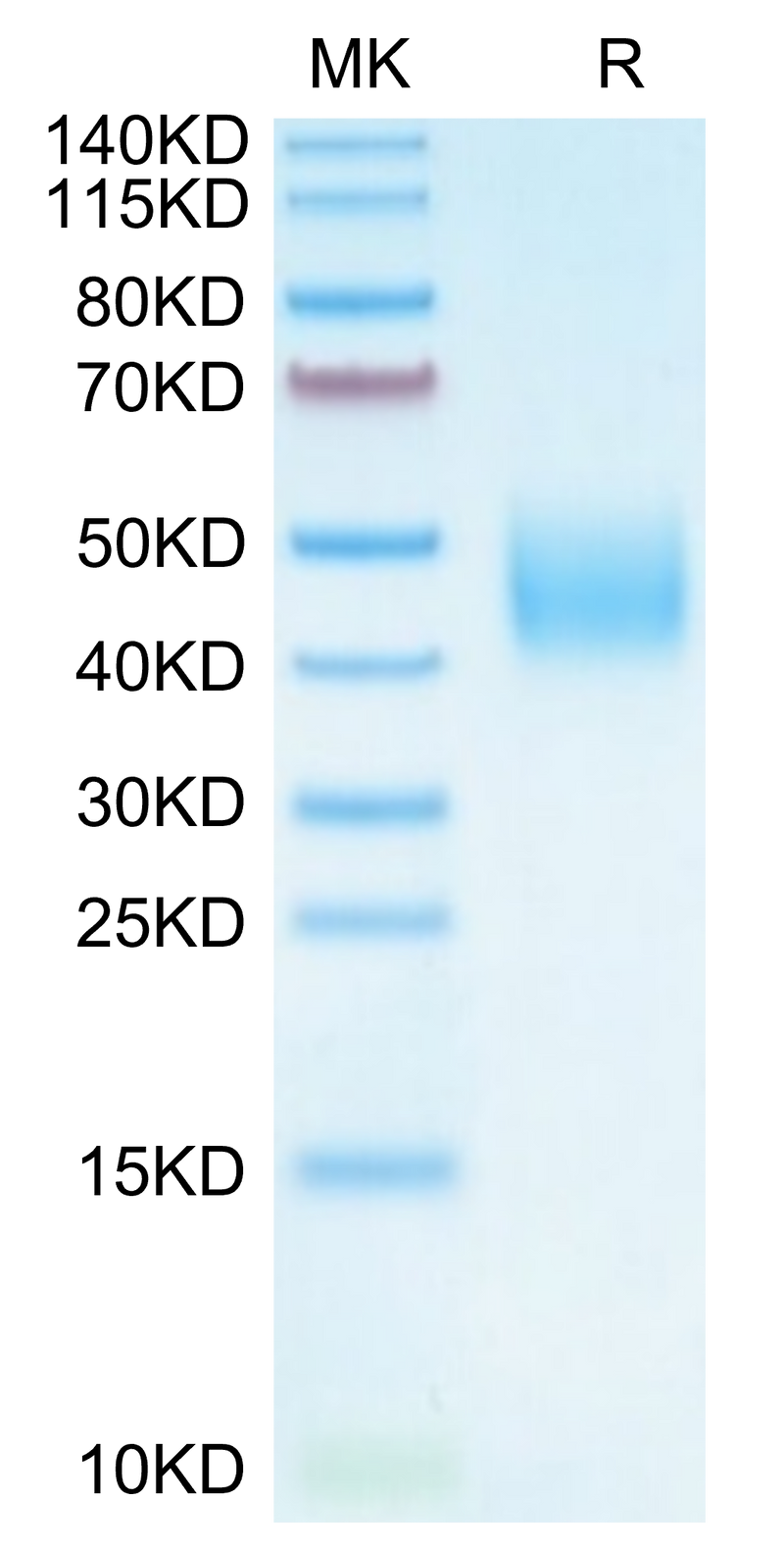 Cynomolgus B7-H6 on Tris-Bis PAGE under reduced condition. The purity is greater than 95%.Recombinant Cynomolgus B7-H6/NCR3LG1 Protein, Active