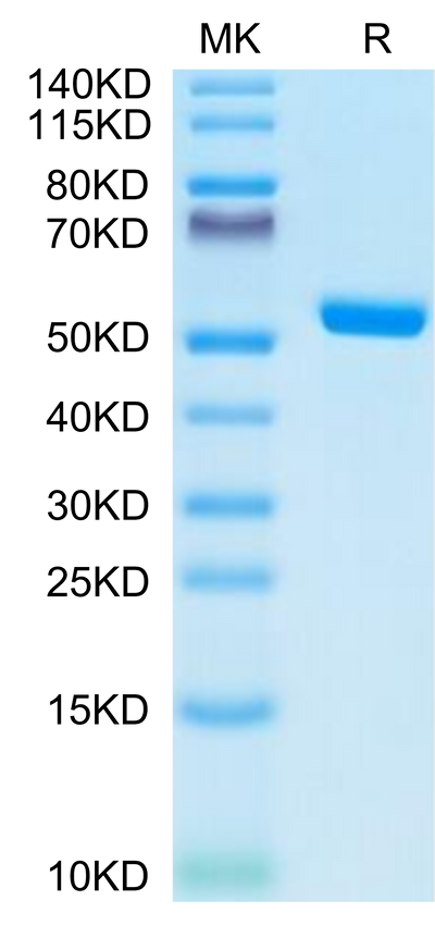 Human HLA-A*02:01&B2M&NY-ESO-1 (SLLMWITQC) Monomer on Tris-Bis PAGE under reduced condition. The purity is greater than 95%.Recombinant Human HLA-A*02:01&B2M&NY-ESO-1 (SLLMWITQC) Monomer Protein, Active